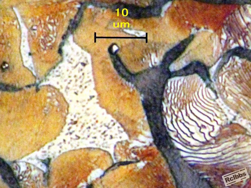 Steadite in the matrix of Pearlite